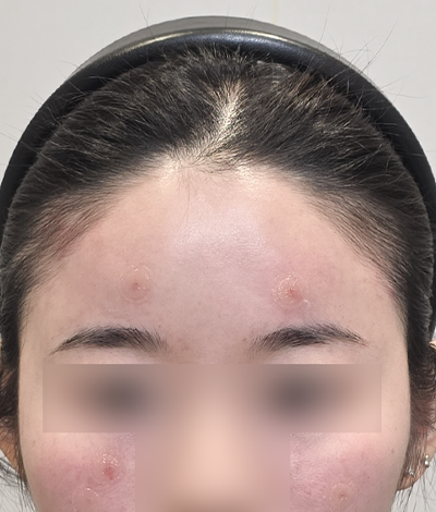 After