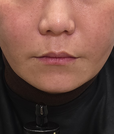 After