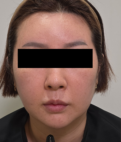 After