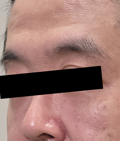 After