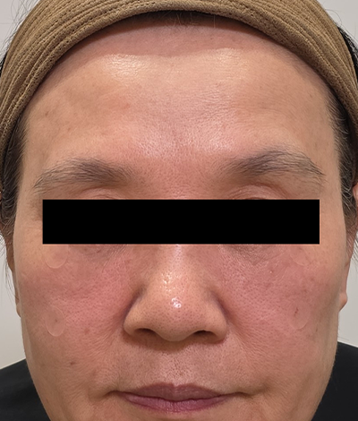 After