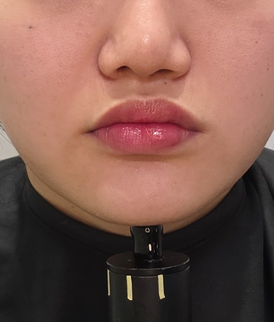 Before