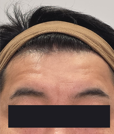 Before