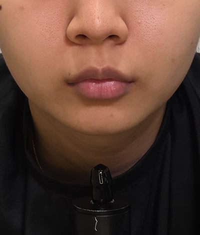 Before