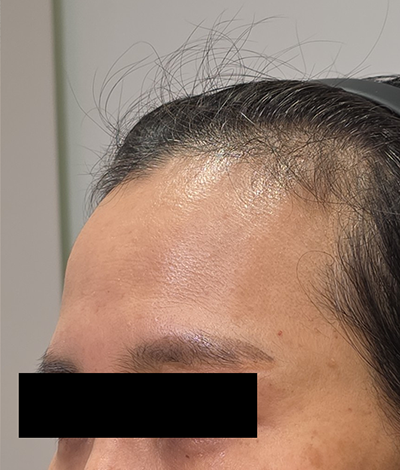 Before