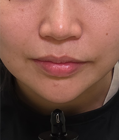 Before