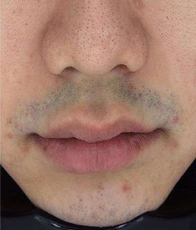 Before