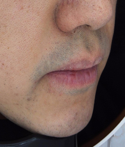 Before