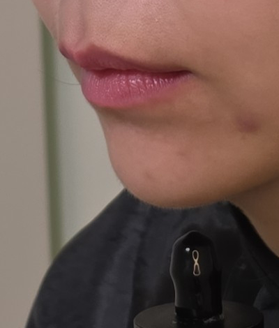 Before