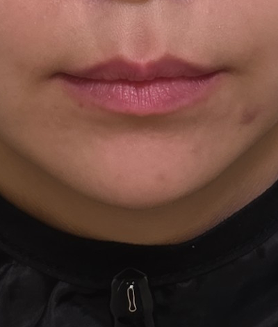 Before