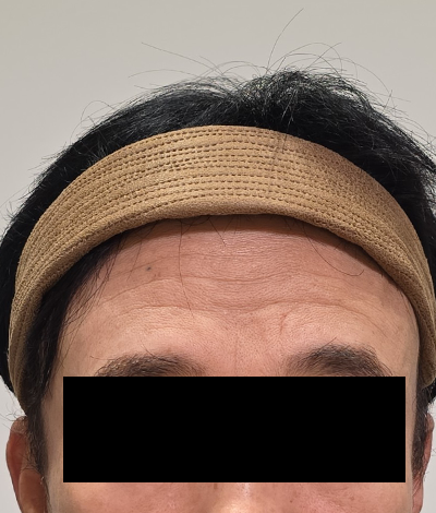 Before